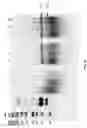 Fig. 02 - Methods of processing ß-lactoglobulin-containing compositions with thermolysin and transglutaminase