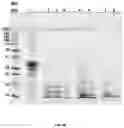 Fig. 08 - Methods of processing ß-lactoglobulin-containing compositions with thermolysin and transglutaminase