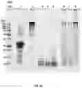 Fig. 09 - Methods of processing ß-lactoglobulin-containing compositions with thermolysin and transglutaminase