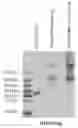 Fig. 01 - SIRPalpha-41BBL fusion protein and methods of use thereof