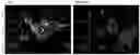Fig. 01 - NOVEL IGFR_LIKE 2 RECEPTOR AND USES THEREOF