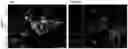 Fig. 02 - NOVEL IGFR_LIKE 2 RECEPTOR AND USES THEREOF