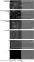 Fig. 72 - CHIMERIC ANTIBODIES COMPRISING BINDING DOMAINS OF PHAGE LYSINS, BACTERIAL AUTOLYSINS, BACTERIOCINS, AND PHAGE TAIL OR TAIL FIBERS