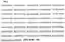 Fig. 09 - ANTIGEN ASSOCIATED WITH RHEUMATOID ARTHRITIS