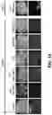Fig. 09 - ENZYMATIC MODIFICATION OF ANTI-AQP4 AUTOANTIBODY FOR MODULATING NEUROMYELITIS OPTICA