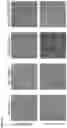 Fig. 02 - MULTIPLE TRANSGENE RECOMBINANT ADENOVIRUS