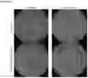 Fig. 07 - MULTIPLE TRANSGENE RECOMBINANT ADENOVIRUS