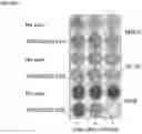 Fig. 08 - MULTIPLE TRANSGENE RECOMBINANT ADENOVIRUS