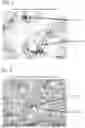 Fig. 05 - Composite roll for rolling