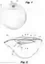 Fig. 02 - Valve assembly for inflatable bladder and method of manufacturing the same