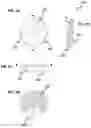 Fig. 03 - Device for measuring of forces and weighing device