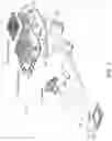 Fig. 02 - Method of determining surgical margins using fluorescence biopsy specimen imager