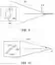 Fig. 08 - Method of determining surgical margins using fluorescence biopsy specimen imager