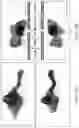 Fig. 09 - Method of determining surgical margins using fluorescence biopsy specimen imager