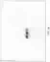 Fig. 32 - Method of determining surgical margins using fluorescence biopsy specimen imager
