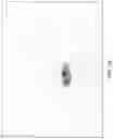 Fig. 37 - Method of determining surgical margins using fluorescence biopsy specimen imager