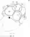 Fig. 09 - Systems for a radio frequency coil for MR imaging