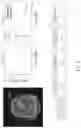 Fig. 15 - System and method for image processing with highly undersampled imaging data