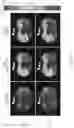 Fig. 17 - System and method for image processing with highly undersampled imaging data