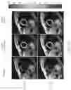 Fig. 19 - System and method for image processing with highly undersampled imaging data