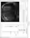 Fig. 25 - System and method for image processing with highly undersampled imaging data