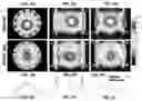 Fig. 06 - METHOD OF UTILITZATION OF HIGH DIELECTRIC CONSTANT (HDC) MATERIALS FOR REDUCING SAR AND ENHANCING SNR IN MRI