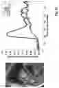 Fig. 07 - Deep learning reconstruction of free breathing perfusion