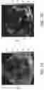 Fig. 08 - Systems and methods for ultrafast ultrasound imaging