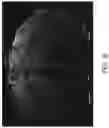 Fig. 09 - Systems and methods for ultrafast ultrasound imaging