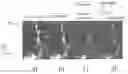 Fig. 01 - Method for providing an overview image