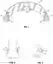 Fig. 02 - STEMLESS MOUNTING SYSTEM FOR AN EYEWEAR LENS