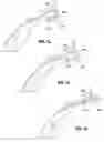 Fig. 08 - STEMLESS MOUNTING SYSTEM FOR AN EYEWEAR LENS