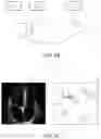 Fig. 08 - System and method for orientating capture of ultrasound images
