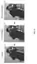 Fig. 06 - Method and device for de-noising images