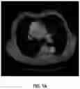 Fig. 02 - Anatomy segmentation through low-resolution multi-atlas label fusion and corrective learning