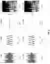 Fig. 06 - Spectrogram to waveform synthesis using convolutional networks