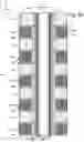 Fig. 08 - Memory device with vpass step to reduce hot carrier injection type of program disturb