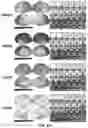 Fig. 08 - Methods and systems for computer-generated predictive application of neuroimaging and gene expression mapping data