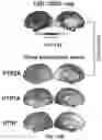 Fig. 23 - Methods and systems for computer-generated predictive application of neuroimaging and gene expression mapping data