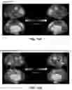 Fig. 28 - Methods and systems for computer-generated predictive application of neuroimaging and gene expression mapping data