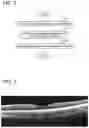 Fig. 03 - Tomographic image processing device, ophthalmic device comprising the same and non-transitory computer-readable recording medium storing computer-readable instructions for tomographic image processing device