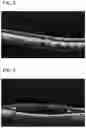 Fig. 04 - Tomographic image processing device, ophthalmic device comprising the same and non-transitory computer-readable recording medium storing computer-readable instructions for tomographic image processing device