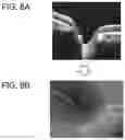 Fig. 07 - Tomographic image processing device, ophthalmic device comprising the same and non-transitory computer-readable recording medium storing computer-readable instructions for tomographic image processing device