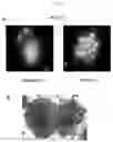 Fig. 05 - having gold nanoparticle synthesis ability, and method for removing radioactive iodine by using same