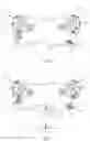 Fig. 03 - Binaural Hearing System