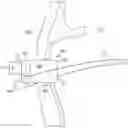 Fig. 01 - Middle ear implant coupler for mechanical cochlea stimulation via the round window
