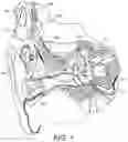 Fig. 02 - Middle ear implant coupler for mechanical cochlea stimulation via the round window