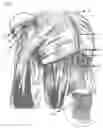 Fig. 04 - Hidden row hair extension method