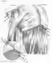 Fig. 07 - Hidden row hair extension method