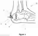 Fig. 02 - STRAIN-RELIEF ELEMENT FOR FOOTWEAR ARTICLES
